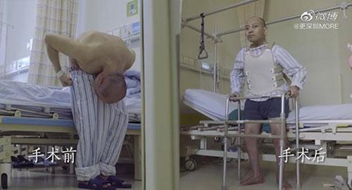 身體被敲斷4次的折疊人出院，打開折疊人生(圖15)
