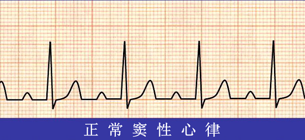 救命神器AED有多重要——你認(rèn)識它嗎？(圖6)